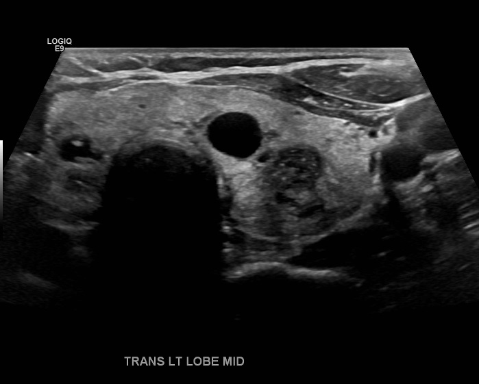 Ultrasound River Radiology